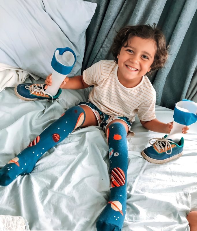 A smiling young boy living with CMT sits on a bed wearing space-patterned leg braces, holding his orthotic braces with his sneakers beside him.